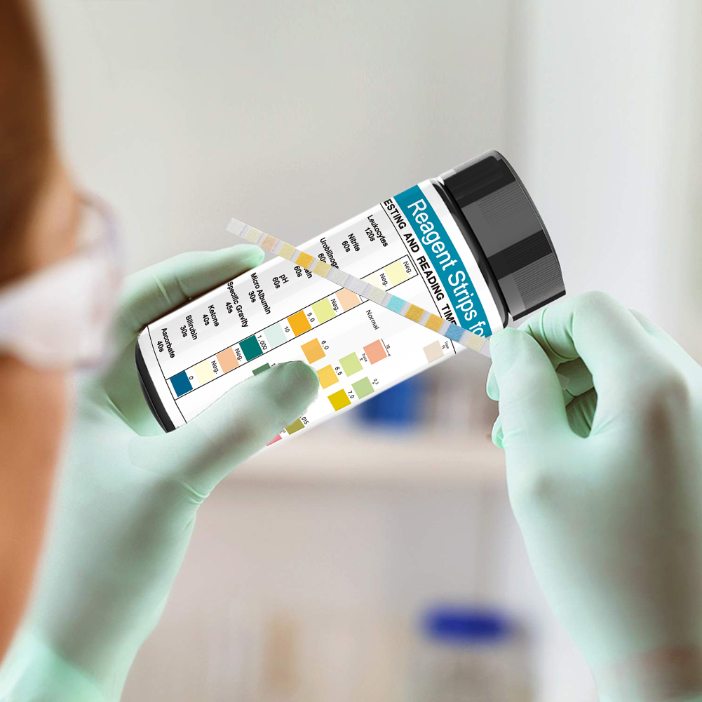 100 şeritler İdrar Test şeridi - Urinalysis Reagent Strip incelemesi ve fiyatı